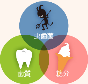 虫歯の原因図